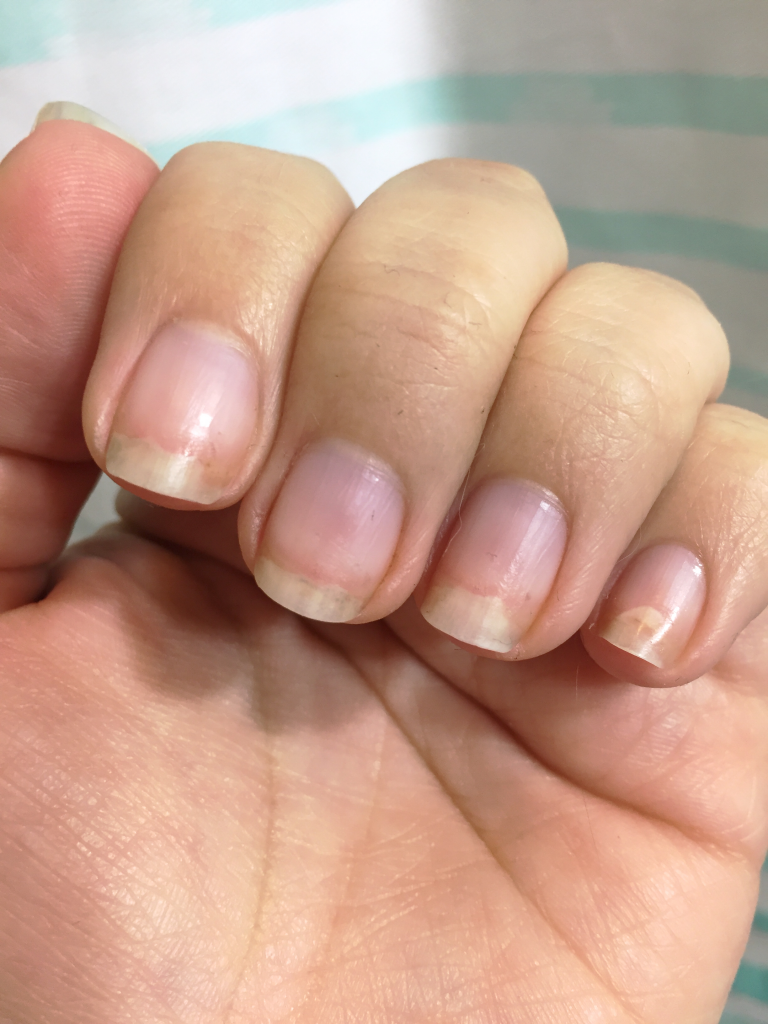 HOW TO REPAIR AND GROW WEAK & DAMAGED NAILS AFTER ACRYLICS 